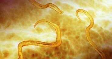 Παράσιτα Pinworm στο ανθρώπινο σώμα