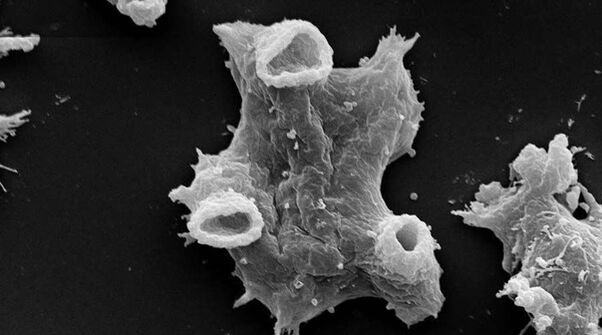 Η Negleria fowlera είναι ένα μονοκύτταρο παράσιτο επικίνδυνο για την ανθρώπινη ζωή. 