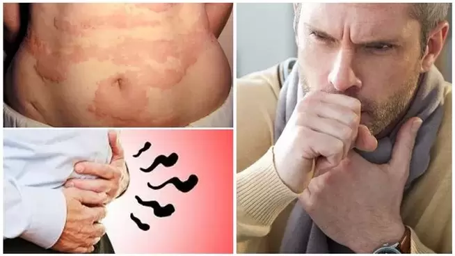 Οι αλλεργίες, ο βήχας και τα αέρια είναι σημάδια βλάβης στο σώμα από σκουλήκια